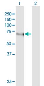 KLF11 Antibody in Western Blot (WB)