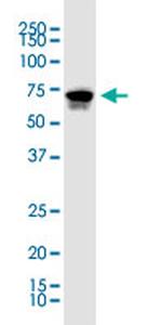 KLF11 Antibody in Western Blot (WB)