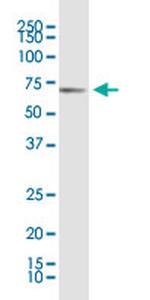 KLF11 Antibody in Western Blot (WB)