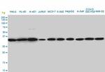 SUPT3H Antibody in Western Blot (WB)