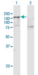 SMARCA5 Antibody in Western Blot (WB)