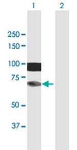 HIRIP3 Antibody in Western Blot (WB)