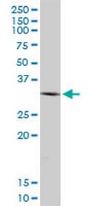 SIP1 Polyclonal Antibody, MaxPab™