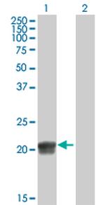 RGS5 Polyclonal Antibody, MaxPab™