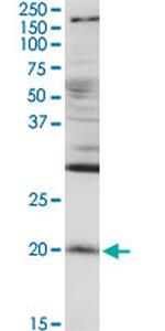 RGS5 Antibody in Western Blot (WB)