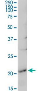 RGS5 Antibody in Western Blot (WB)