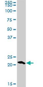 RGS5 Antibody in Western Blot (WB)