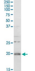 RGS5 Antibody in Western Blot (WB)