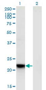 RGS5 Monoclonal Antibody (4E12)