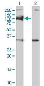 PPM1D Antibody in Western Blot (WB)