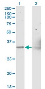 NIPSNAP1 Monoclonal Antibody (3B7)