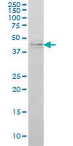 IKBKG Monoclonal Antibody (4G9)