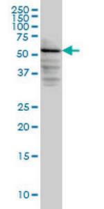 DGKE Monoclonal Antibody (7E1)