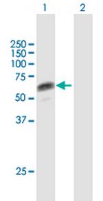 CSDA Polyclonal Antibody, MaxPab™