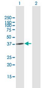 CBX4 Antibody in Western Blot (WB)