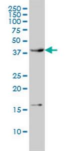CAMK1 Monoclonal Antibody (3G1)