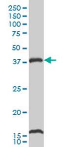 CAMK1 Monoclonal Antibody (2B6)