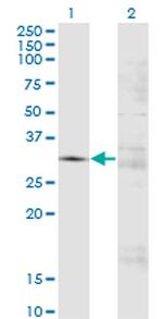 FCN3 Antibody in Western Blot (WB)