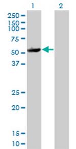 MAPKAPK5 Monoclonal Antibody (2D5)