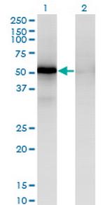 MAPKAPK5 Monoclonal Antibody (3D7)