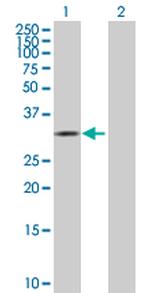 CDK10 Antibody in Western Blot (WB)