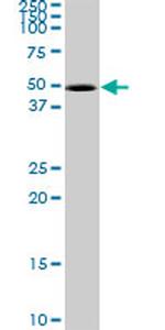 CDK10 Antibody in Western Blot (WB)