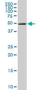 YARS Antibody in Western Blot (WB)
