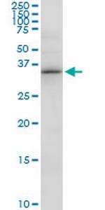 PDXK Polyclonal Antibody, MaxPab™