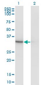 PDXK Monoclonal Antibody (4G6)