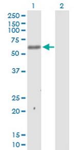 MKNK1 Polyclonal Antibody, MaxPab™