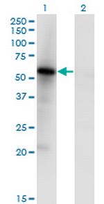 MKNK1 Monoclonal Antibody (5E2)