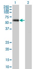 MKNK1 Monoclonal Antibody (3C9)