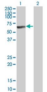 MKNK1 Monoclonal Antibody (3G6)