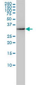 AKR7A2 Monoclonal Antibody (2A6)