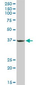 PRKRA Antibody in Western Blot (WB)