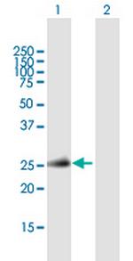 TNFSF11 Antibody in Western Blot (WB)