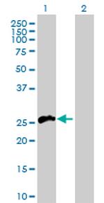 TNFSF11 Antibody in Western Blot (WB)
