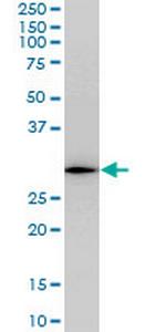 RGS20 Monoclonal Antibody (3E10)