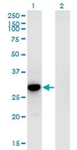 RFXANK Monoclonal Antibody (4G10)