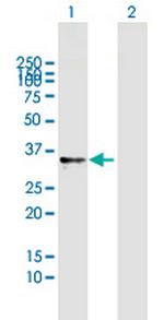 RNASET2 Polyclonal Antibody, MaxPab™