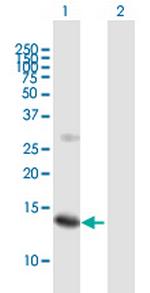 SSNA1 Polyclonal Antibody, MaxPab™