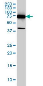 DDX3Y Monoclonal Antibody (2D7)
