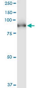 PDE5A Monoclonal Antibody (1F11)