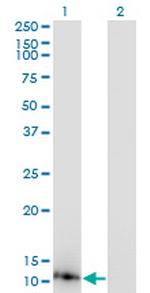 DYNLL1 Monoclonal Antibody (1H7)