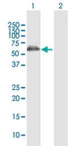 ALDH4A1 Polyclonal Antibody, MaxPab™
