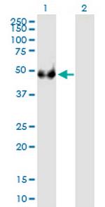 EIF3F Antibody in Western Blot (WB)