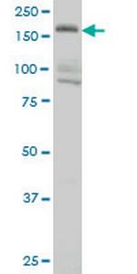 EIF4G3 Antibody in Western Blot (WB)