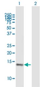 VAMP8 Polyclonal Antibody, MaxPab™
