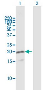 VAMP8 Polyclonal Antibody, MaxPab™