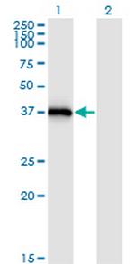 STX16 Antibody in Western Blot (WB)